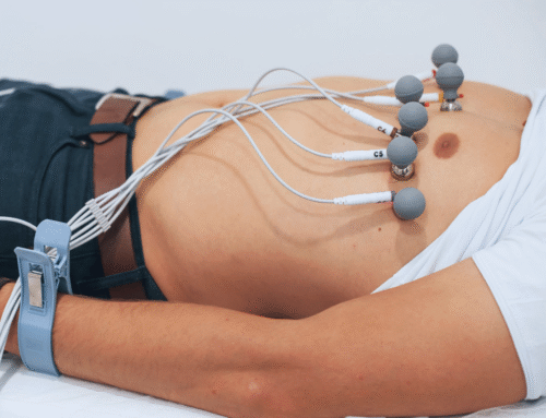 ELETROCARDIOGRAMA: COMO O APARELHO AJUDA A TER UMA VIDA MAIS SAUDÁVEL?