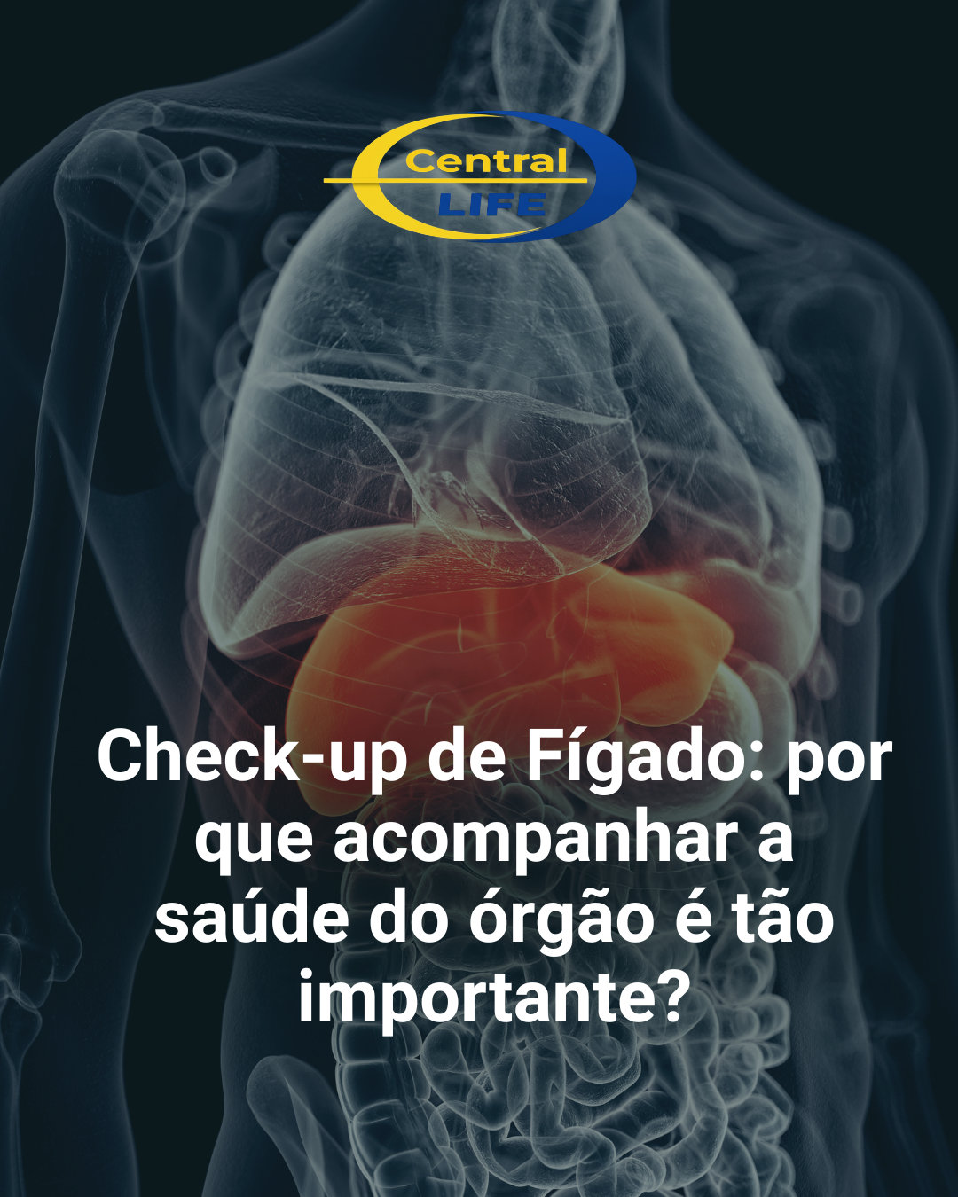 Check-up de Fígado: por que acompanhar a saúde do órgão é tão importante?