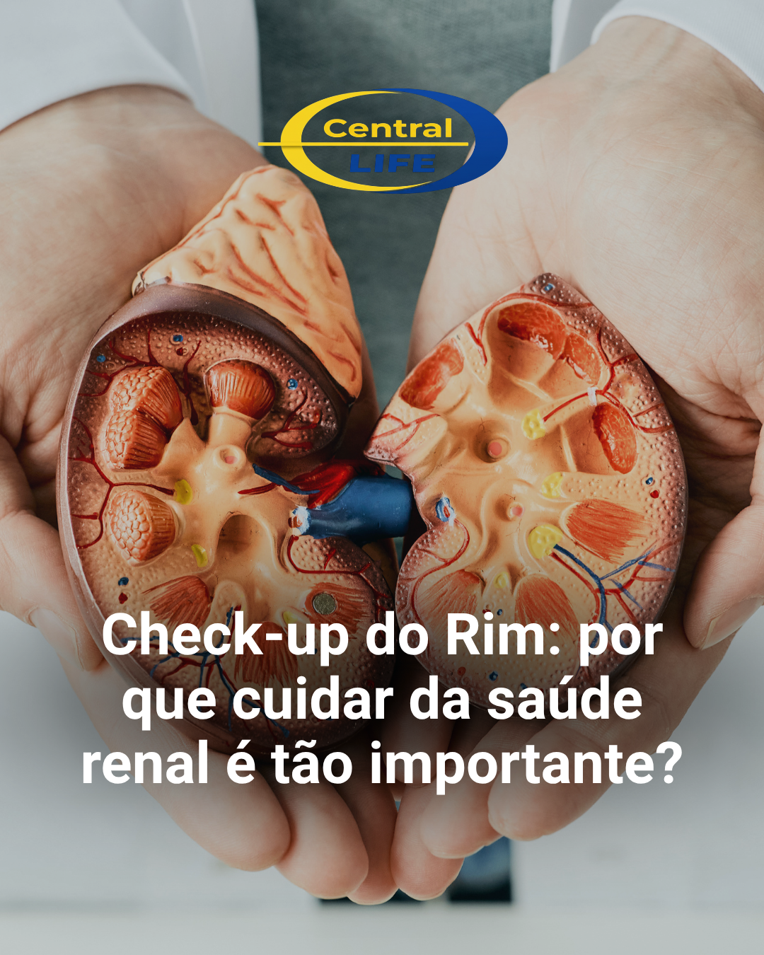 Check-up do Rim: por que cuidar da saúde renal é tão importante?
