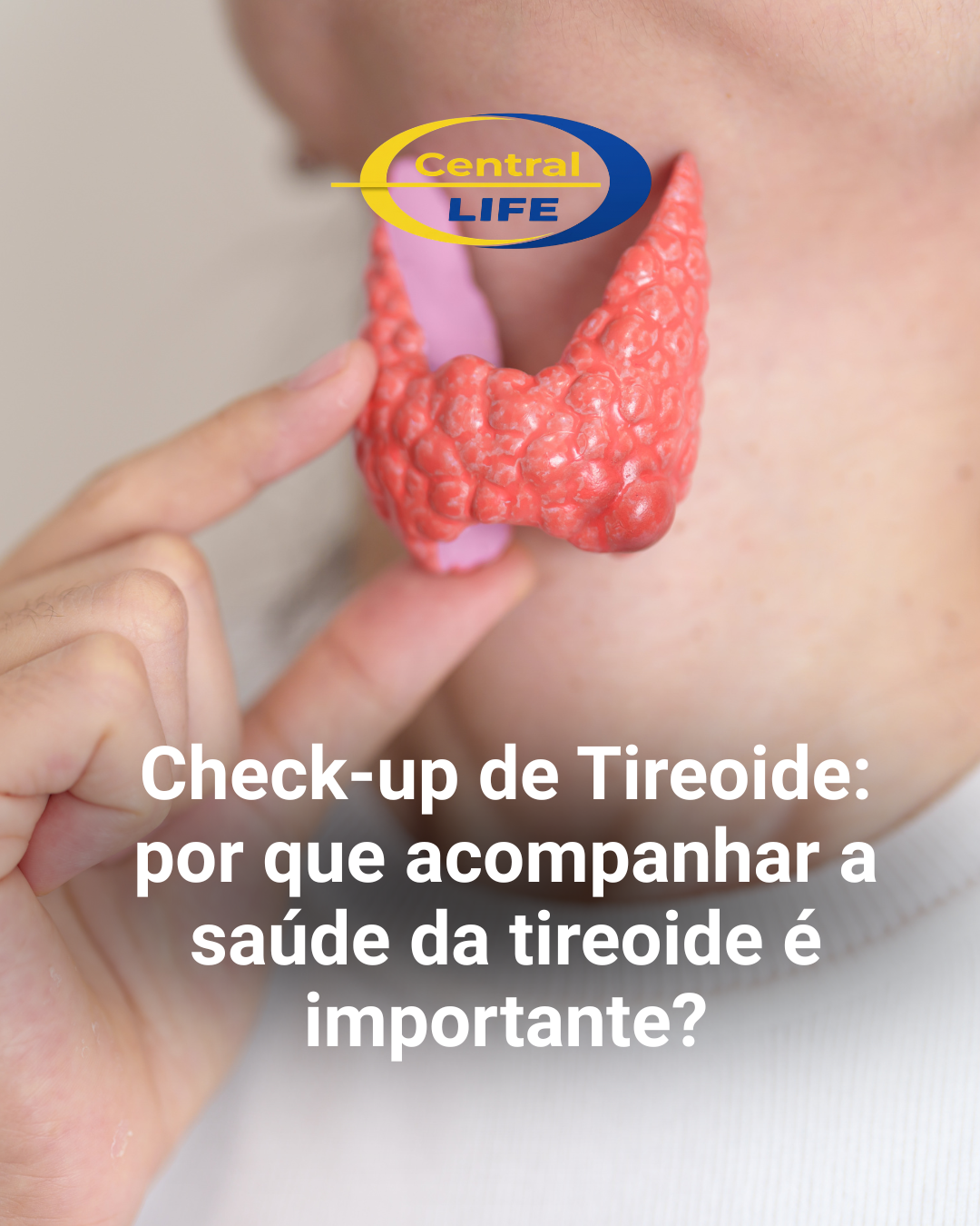Check-up de Tireoide: por que acompanhar a saúde da tireoide é importante?
