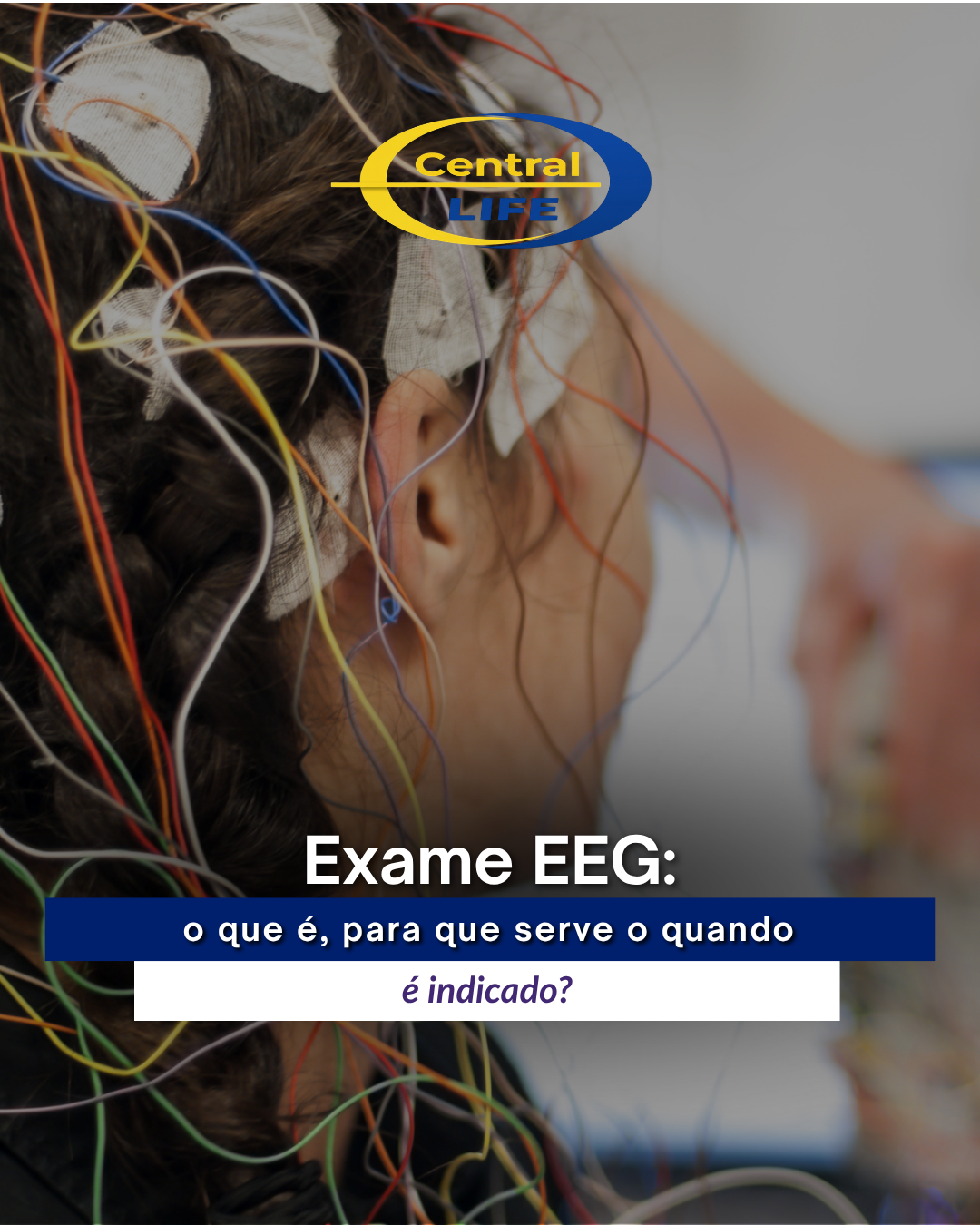 Exame EEG: o que é, para que serve e quando é indicado?