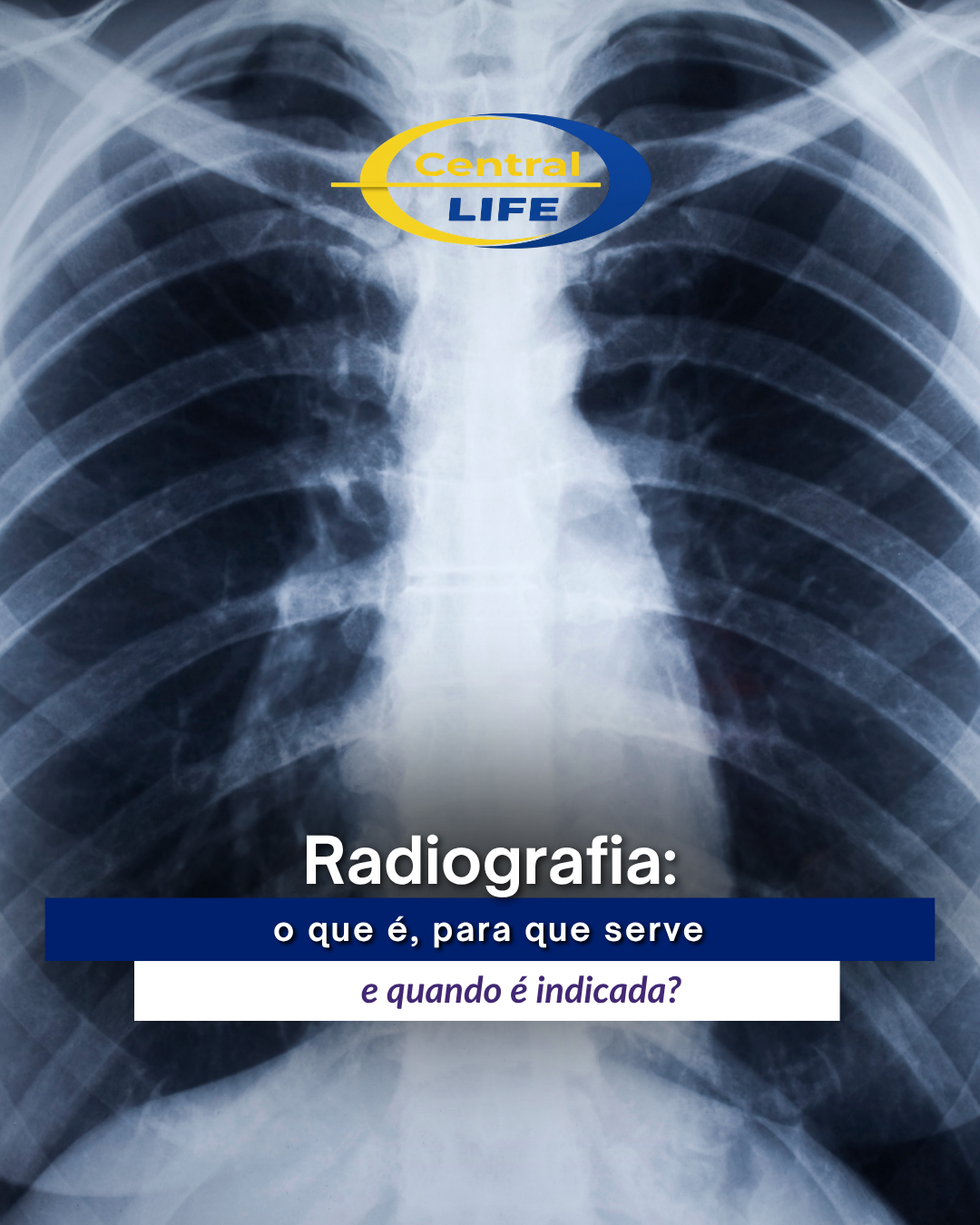 Radiografia: o que é, para que serve e quando é indicada?